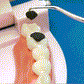 🦷Set de scobitori din oțel inoxidabil
